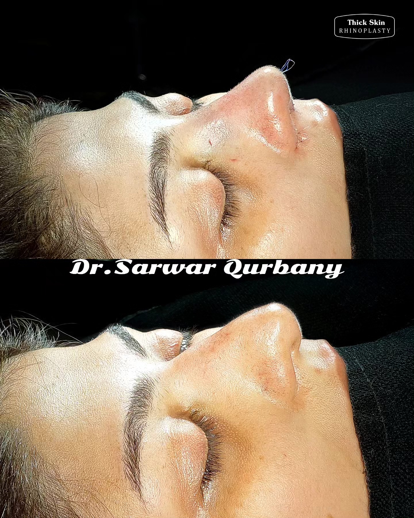European Rhinoplasty Society Annual Meeting
